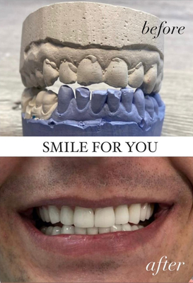 Улыбайтесь чаще! Стоматология «SMILE FOR YOU» дарит скидку до 40% Улыбайтесь чаще! Стоматология «SMILE FOR YOU» дарит скидку до 40%