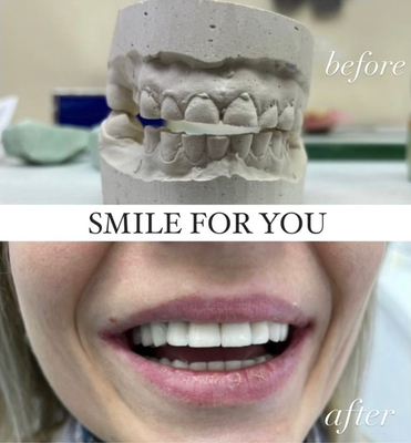 Улыбайтесь чаще! Стоматология «SMILE FOR YOU» дарит скидку до 40% Улыбайтесь чаще! Стоматология «SMILE FOR YOU» дарит скидку до 40%