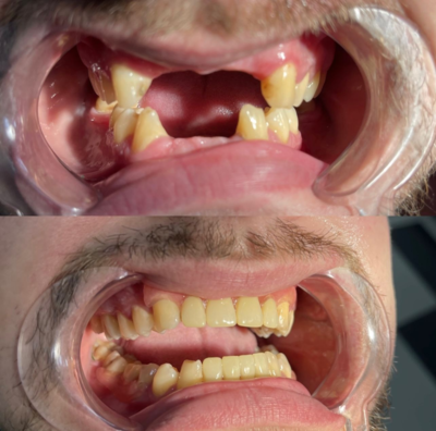 Улыбайтесь чаще! Стоматология «SMILE FOR YOU» дарит скидку до 40% Улыбайтесь чаще! Стоматология «SMILE FOR YOU» дарит скидку до 40%